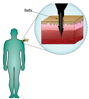 Barbs anchor the stinger into the skin, from where the stinger cannot be retracted when the bee escapes.PNG